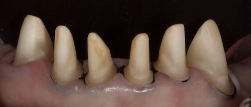 Image of a prepared tooth