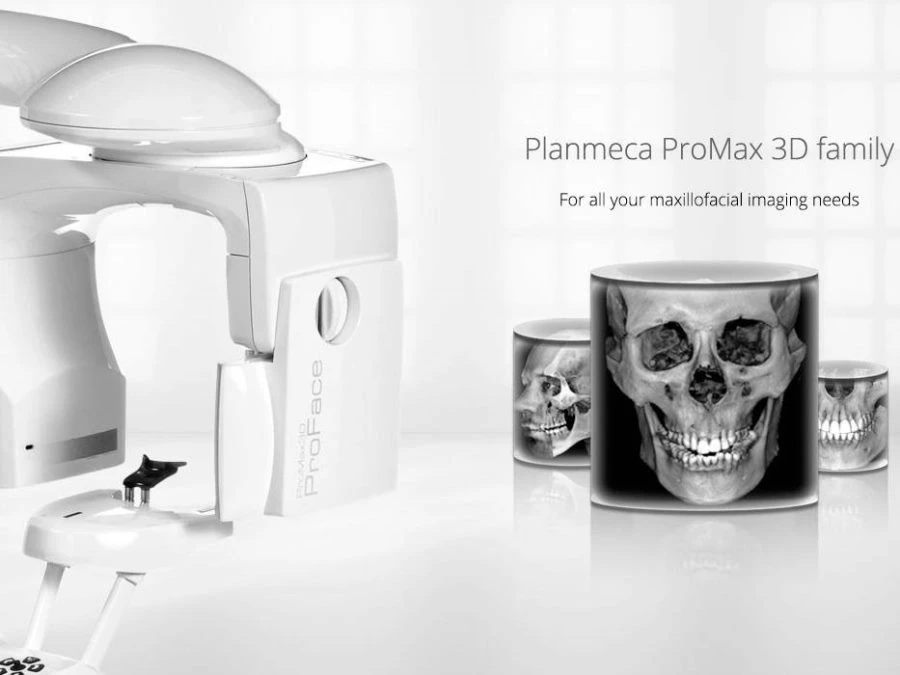 3D CBCT - dental consultation