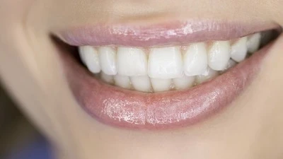 Aesthetic dentistry result