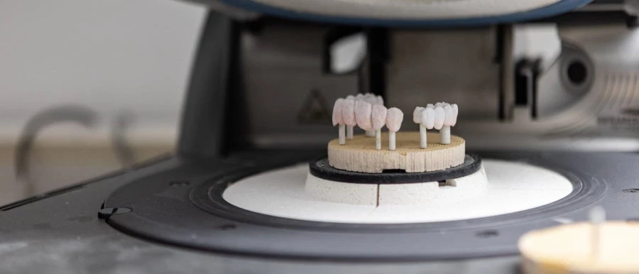 Ceramic layering dental tourism hungary