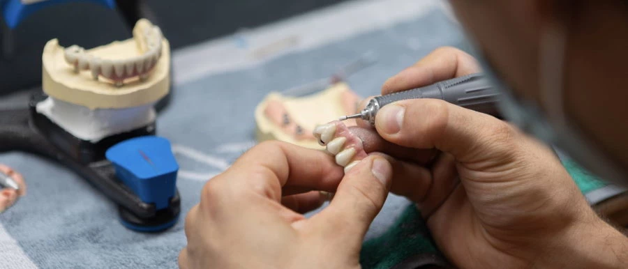 Dental lab work