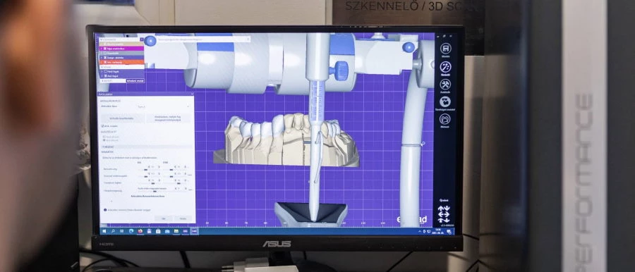 Cad/Cam dentistry hungary